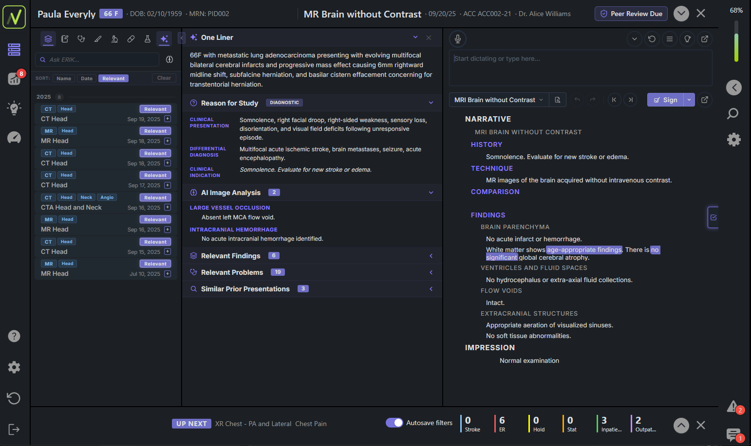 The NewVue Cockpit: worklist, clinical context and reporting in one workspace